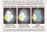 Zone de pénétration des ondes dans le cerveau
