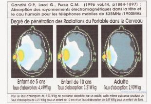 Zone de pénétration des ondes dans le cerveau